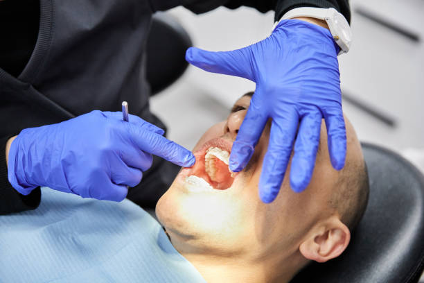 Best Knocked-Out Tooth (Avulsed Tooth) Treatment in Aztec, NM